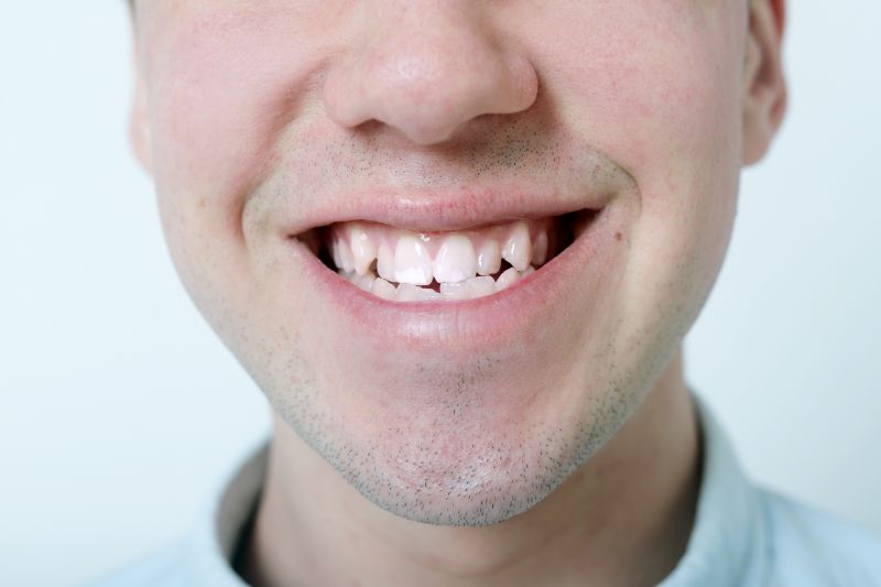 invisalign near you