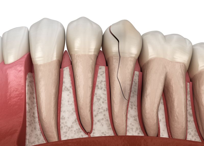 Same-Day Dentist Near You