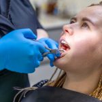 Why Tooth Extraction Might Be the Best Option for Your Oral Health